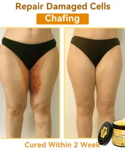 𝐃𝐨𝐫𝐦𝐨𝐫𝐧𝐚® Bee Venom Repair Cream