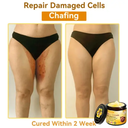 𝐃𝐨𝐫𝐦𝐨𝐫𝐧𝐚® Bee Venom Repair Cream
