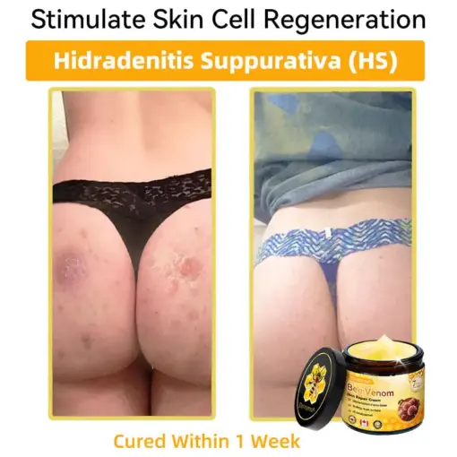 𝐃𝐨𝐫𝐦𝐨𝐫𝐧𝐚® Bee Venom Repair Cream