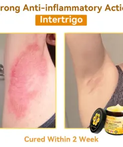 𝐃𝐨𝐫𝐦𝐨𝐫𝐧𝐚® Bee Venom Repair Cream