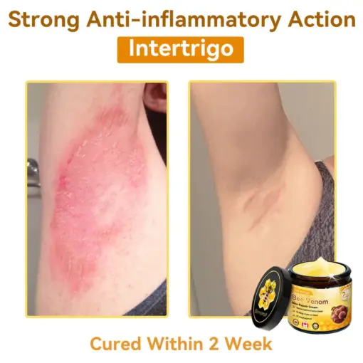 𝐃𝐨𝐫𝐦𝐨𝐫𝐧𝐚® Bee Venom Repair Cream