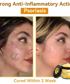𝐃𝐨𝐫𝐦𝐨𝐫𝐧𝐚® Bee Venom Repair Cream