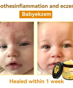 𝐃𝐨𝐫𝐦𝐨𝐫𝐧𝐚® Bee Venom Repair Cream