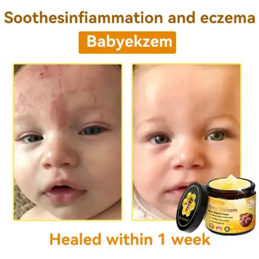 𝐃𝐨𝐫𝐦𝐨𝐫𝐧𝐚® Bee Venom Repair Cream