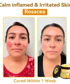 𝐃𝐨𝐫𝐦𝐨𝐫𝐧𝐚® Bee Venom Repair Cream