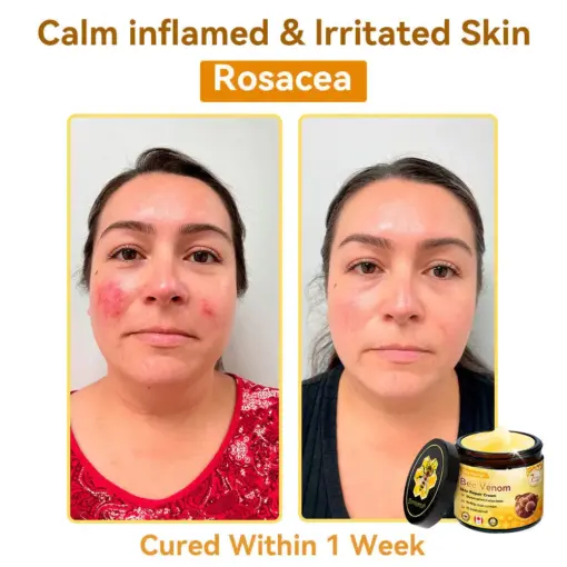 𝐃𝐨𝐫𝐦𝐨𝐫𝐧𝐚® Bee Venom Repair Cream
