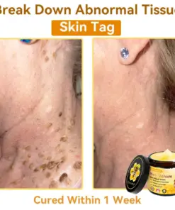 𝐃𝐨𝐫𝐦𝐨𝐫𝐧𝐚® Bee Venom Repair Cream