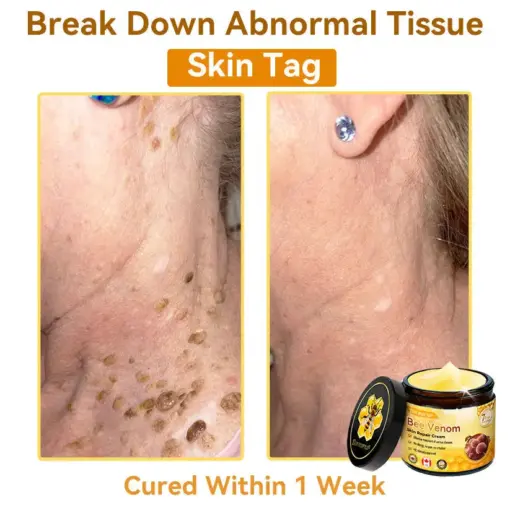 𝐃𝐨𝐫𝐦𝐨𝐫𝐧𝐚® Bee Venom Repair Cream