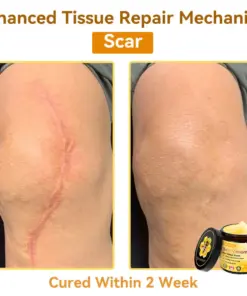𝐃𝐨𝐫𝐦𝐨𝐫𝐧𝐚® Bee Venom Repair Cream