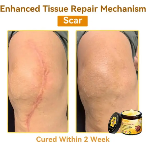 𝐃𝐨𝐫𝐦𝐨𝐫𝐧𝐚® Bee Venom Repair Cream