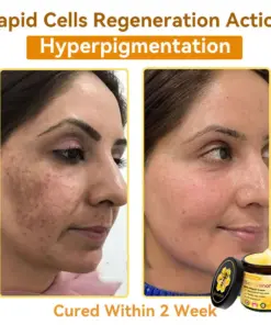 𝐃𝐨𝐫𝐦𝐨𝐫𝐧𝐚® Bee Venom Repair Cream