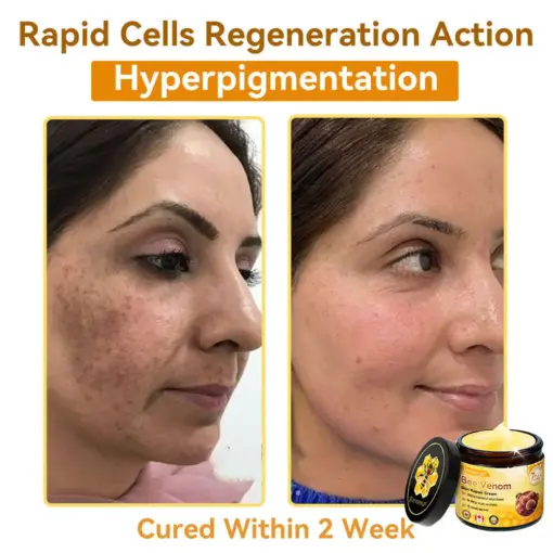 𝐃𝐨𝐫𝐦𝐨𝐫𝐧𝐚® Bee Venom Repair Cream
