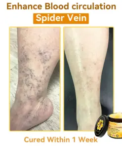 𝐃𝐨𝐫𝐦𝐨𝐫𝐧𝐚® Bee Venom Repair Cream