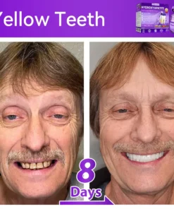 𝐷𝑜𝑟𝑚𝑜𝑟𝑛𝑎® 𝐻𝑦𝑑𝑟𝑜𝑥𝑦𝑎𝑝𝑎𝑡𝑖𝑡𝑒 𝑇𝑜𝑜𝑡ℎ 𝑅𝑒𝑠𝑡𝑜𝑟𝑎𝑡𝑖𝑣𝑒 𝑃𝑜𝑤𝑑𝑒𝑟