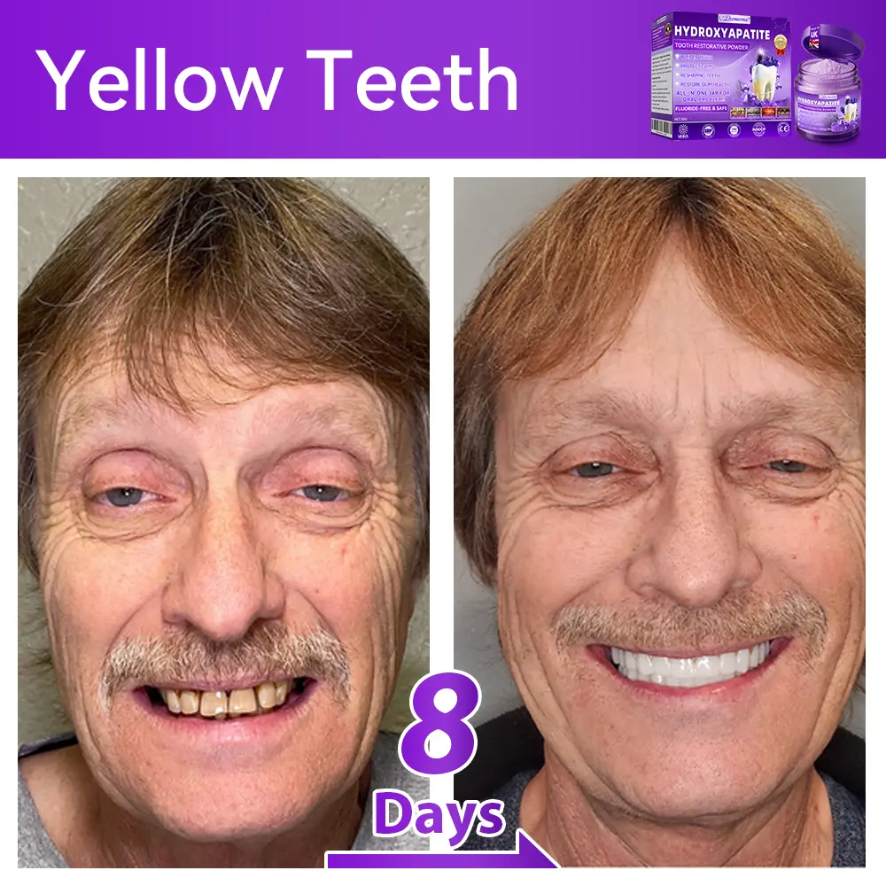 ๐ท๐๐๐๐๐๐๐ยฎ ๐ป๐ฆ๐๐๐๐ฅ๐ฆ๐๐๐๐ก๐๐ก๐ ๐๐๐๐กโ ๐
๐๐ ๐ก๐๐๐๐ก๐๐ฃ๐ ๐๐๐ค๐๐๐