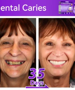 ๐ท๐๐๐๐๐๐๐ยฎ ๐ป๐ฆ๐๐๐๐ฅ๐ฆ๐๐๐๐ก๐๐ก๐ ๐๐๐๐กโ ๐
๐๐ ๐ก๐๐๐๐ก๐๐ฃ๐ ๐๐๐ค๐๐๐