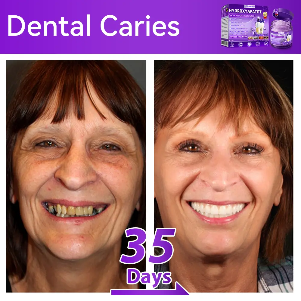 ๐ท๐๐๐๐๐๐๐ยฎ ๐ป๐ฆ๐๐๐๐ฅ๐ฆ๐๐๐๐ก๐๐ก๐ ๐๐๐๐กโ ๐
๐๐ ๐ก๐๐๐๐ก๐๐ฃ๐ ๐๐๐ค๐๐๐