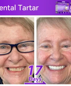 ๐ท๐๐๐๐๐๐๐ยฎ ๐ป๐ฆ๐๐๐๐ฅ๐ฆ๐๐๐๐ก๐๐ก๐ ๐๐๐๐กโ ๐
๐๐ ๐ก๐๐๐๐ก๐๐ฃ๐ ๐๐๐ค๐๐๐