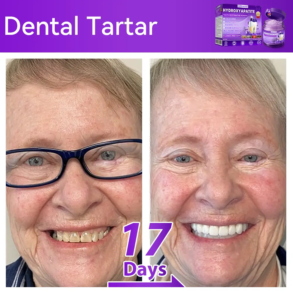 ๐ท๐๐๐๐๐๐๐ยฎ ๐ป๐ฆ๐๐๐๐ฅ๐ฆ๐๐๐๐ก๐๐ก๐ ๐๐๐๐กโ ๐
๐๐ ๐ก๐๐๐๐ก๐๐ฃ๐ ๐๐๐ค๐๐๐