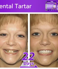 ๐ท๐๐๐๐๐๐๐ยฎ ๐ป๐ฆ๐๐๐๐ฅ๐ฆ๐๐๐๐ก๐๐ก๐ ๐๐๐๐กโ ๐
๐๐ ๐ก๐๐๐๐ก๐๐ฃ๐ ๐๐๐ค๐๐๐