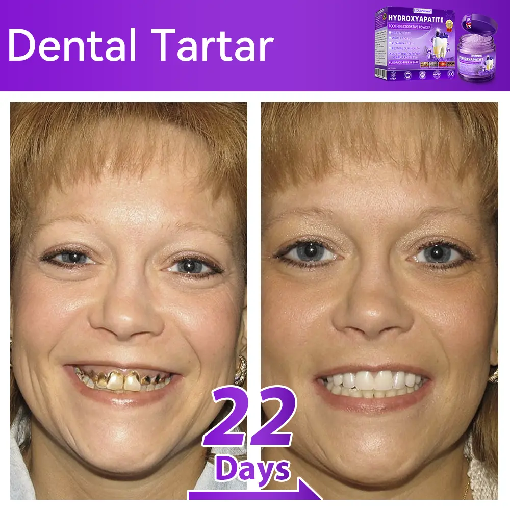 ๐ท๐๐๐๐๐๐๐ยฎ ๐ป๐ฆ๐๐๐๐ฅ๐ฆ๐๐๐๐ก๐๐ก๐ ๐๐๐๐กโ ๐
๐๐ ๐ก๐๐๐๐ก๐๐ฃ๐ ๐๐๐ค๐๐๐