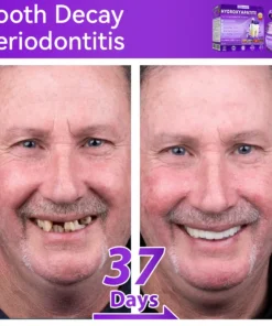 ๐ท๐๐๐๐๐๐๐ยฎ ๐ป๐ฆ๐๐๐๐ฅ๐ฆ๐๐๐๐ก๐๐ก๐ ๐๐๐๐กโ ๐
๐๐ ๐ก๐๐๐๐ก๐๐ฃ๐ ๐๐๐ค๐๐๐