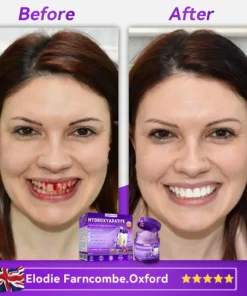 ๐ท๐๐๐๐๐๐๐ยฎ ๐ป๐ฆ๐๐๐๐ฅ๐ฆ๐๐๐๐ก๐๐ก๐ ๐๐๐๐กโ ๐
๐๐ ๐ก๐๐๐๐ก๐๐ฃ๐ ๐๐๐ค๐๐๐