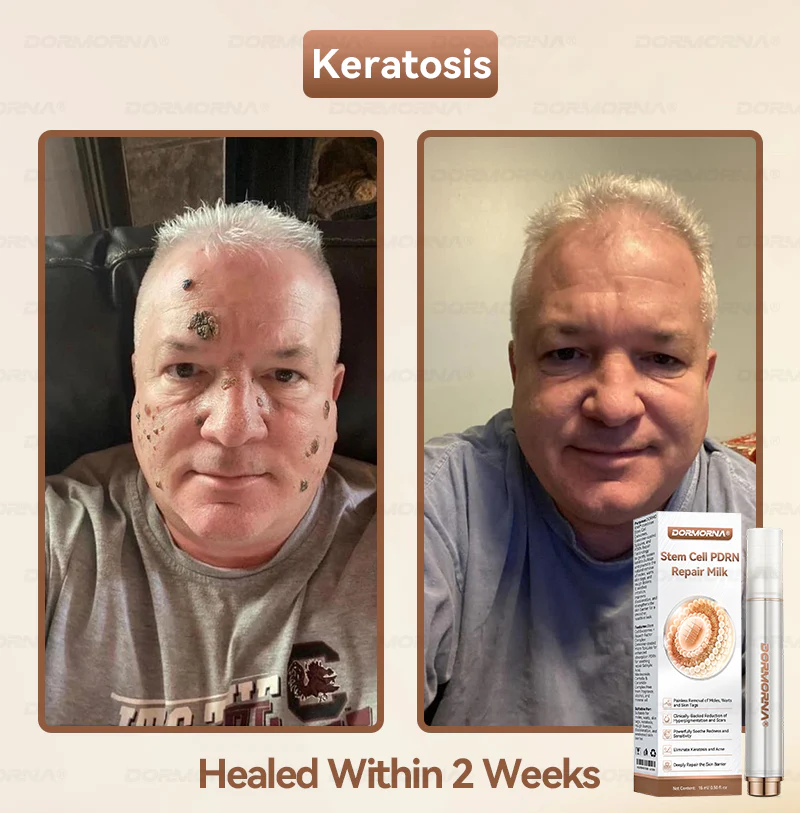 ๐ท๐๐
๐๐๐
๐๐ดยฎ ๐๐ญ๐๐ฆ ๐๐๐ฅ๐ฅ ๐๐๐๐ ๐๐๐ฉ๐๐ข๐ซ ๐๐ข๐ฅ๐ค ๐๐๐๐๐๐๐ ๐๐ฑ๐จ๐ฌ๐จ๐ฆ๐-๐๐ง๐๐ฎ๐ฌ๐๐ ๐๐จ๐ซ ๐๐ค๐ข๐ง ๐๐๐ ๐๐ง๐๐ซ๐๐ญ๐ข๐จ๐ง & ๐๐ฆ๐ฉ๐๐ซ๐๐๐๐ญ๐ข๐จ๐ง ๐๐จ๐ซ๐ซ๐๐๐ญ๐ข๐จ๐ง - Image 3