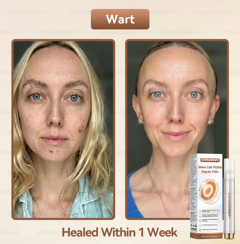 ๐ท๐๐
๐๐๐
๐๐ดยฎ ๐๐ญ๐๐ฆ ๐๐๐ฅ๐ฅ ๐๐๐๐ ๐๐๐ฉ๐๐ข๐ซ ๐๐ข๐ฅ๐ค ๐๐๐๐๐๐๐ ๐๐ฑ๐จ๐ฌ๐จ๐ฆ๐-๐๐ง๐๐ฎ๐ฌ๐๐ ๐๐จ๐ซ ๐๐ค๐ข๐ง ๐๐๐ ๐๐ง๐๐ซ๐๐ญ๐ข๐จ๐ง & ๐๐ฆ๐ฉ๐๐ซ๐๐๐๐ญ๐ข๐จ๐ง ๐๐จ๐ซ๐ซ๐๐๐ญ๐ข๐จ๐ง - Image 2